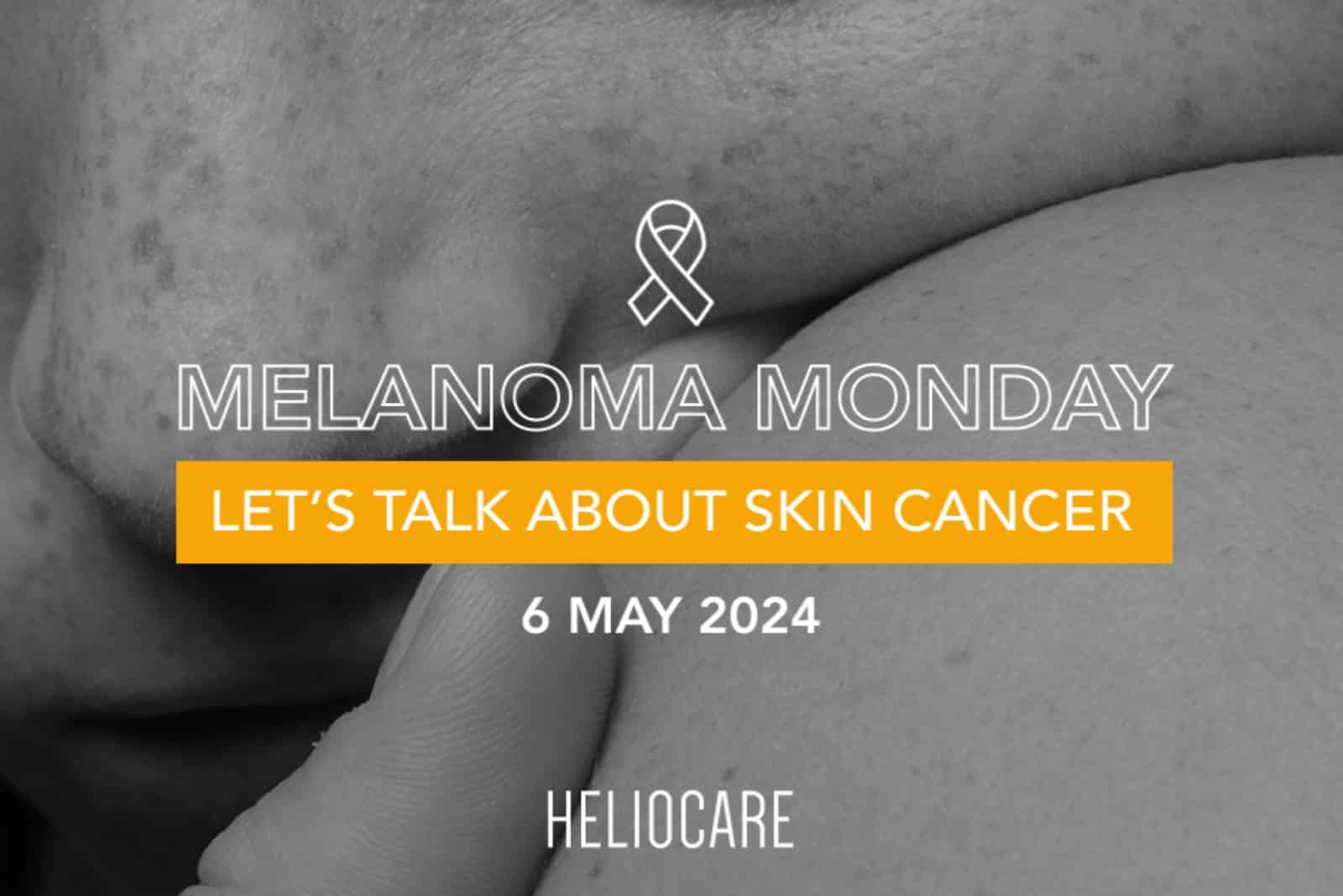 Read more about the article Heliocare Celebrates Melanoma Monday with Focus on Fernblock® Benefits